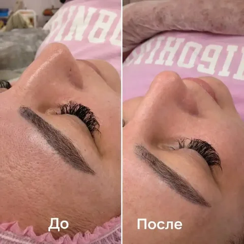 Услуги косметолога для моделей - Стоматология в Самара