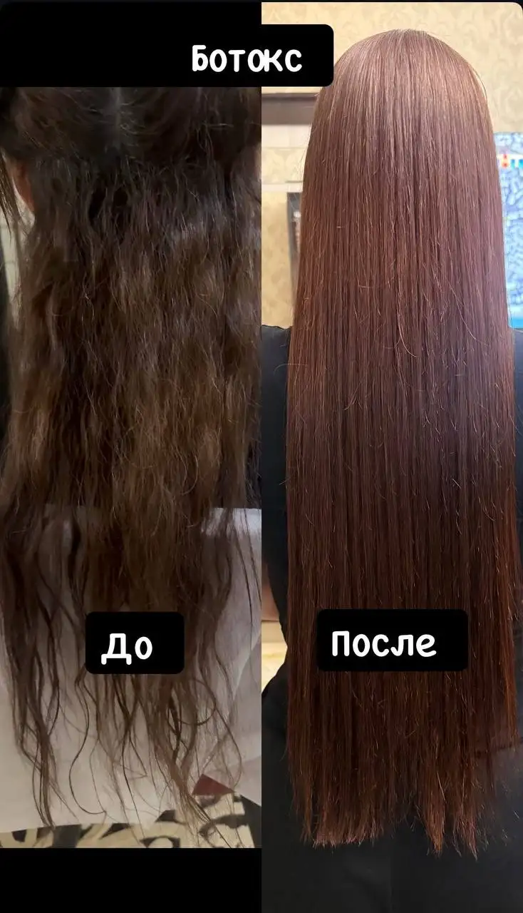 Услуги ботокса, кератина и системы похудения - Косметология (Красота и здоровье) в Махачкала