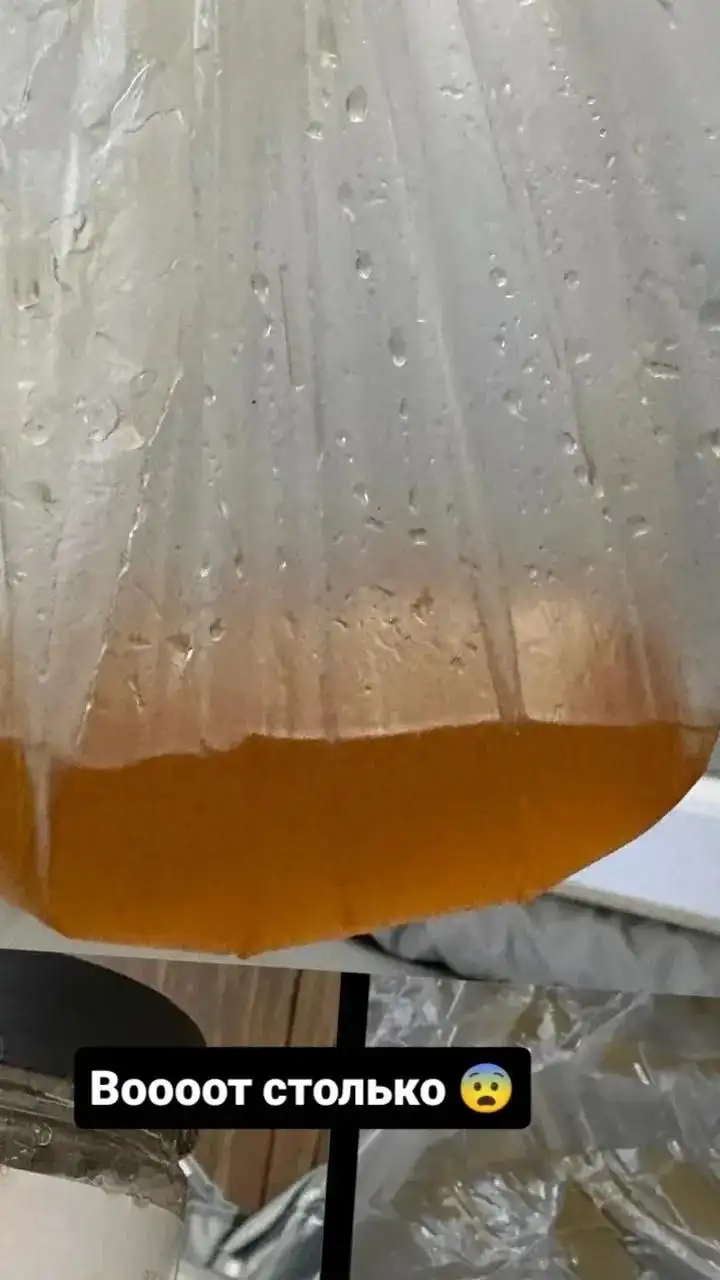 Коррекция фигуры в центре города - Красота и здоровье (Услуги) в Чебоксары