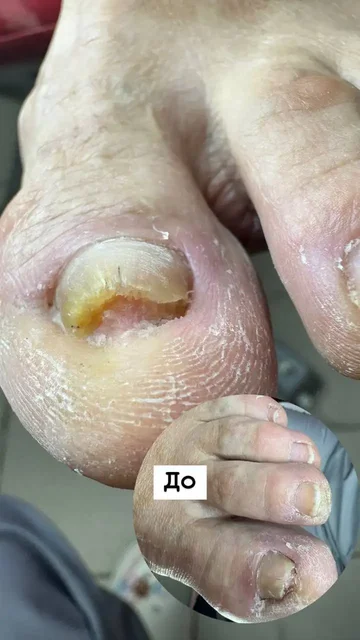 Педикюр с заботой о здоровье с выездом на дом - Погода в Владивосток