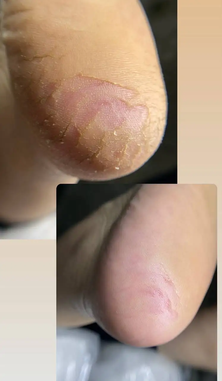 Педикюр с заботой о здоровье с выездом на дом - Красота и здоровье (Услуги) в Владивосток