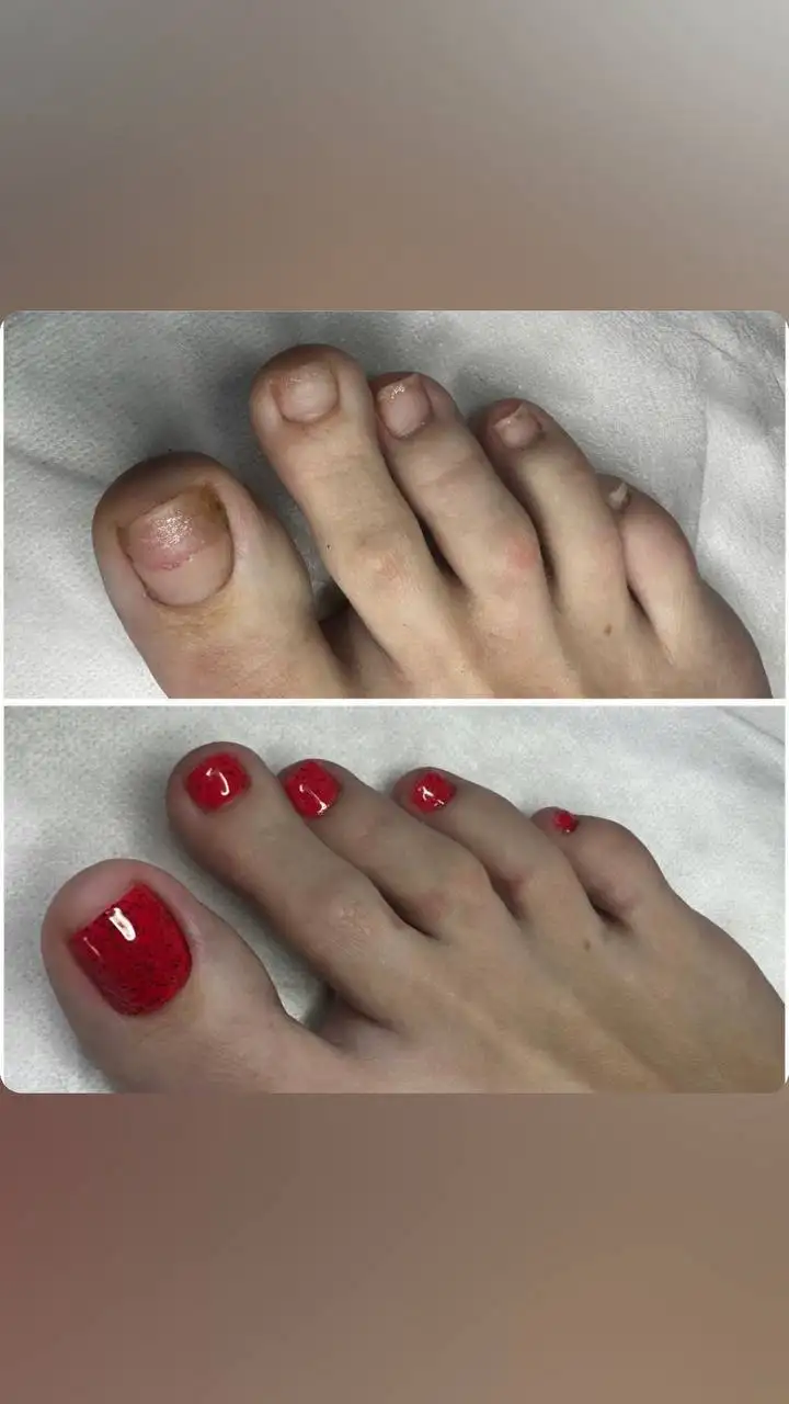 Педикюр с заботой о здоровье с выездом на дом - Красота и здоровье (Услуги) в Владивосток