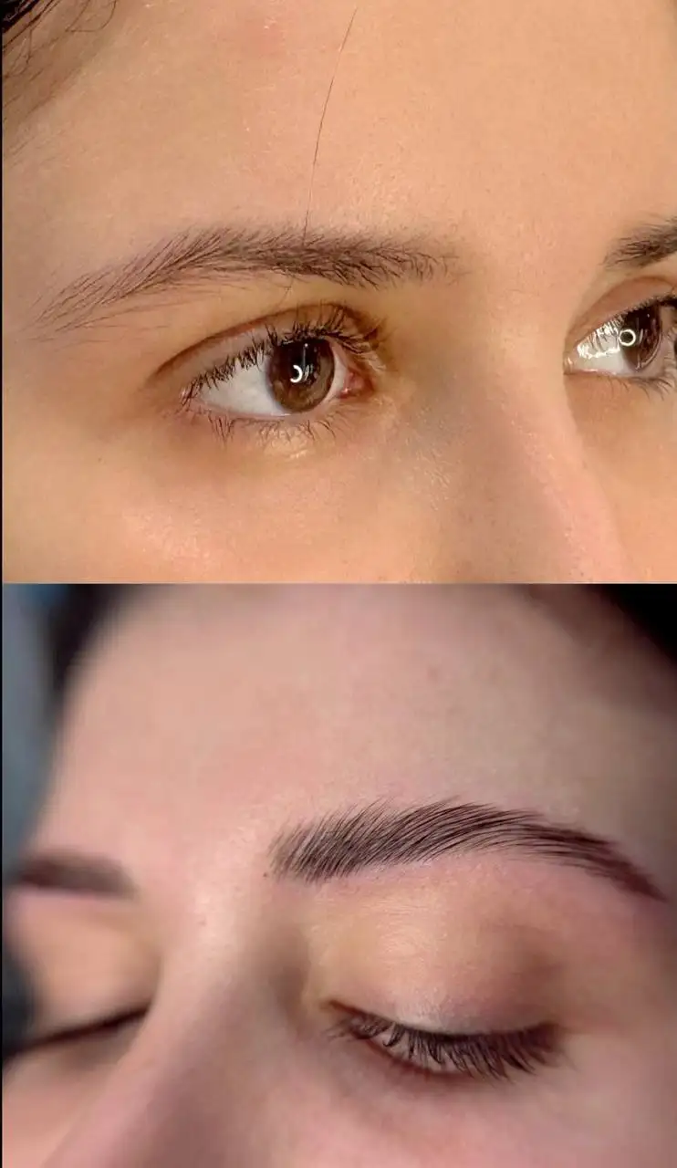 Требуются модели для косметических процедур - Услуги в Мытищи