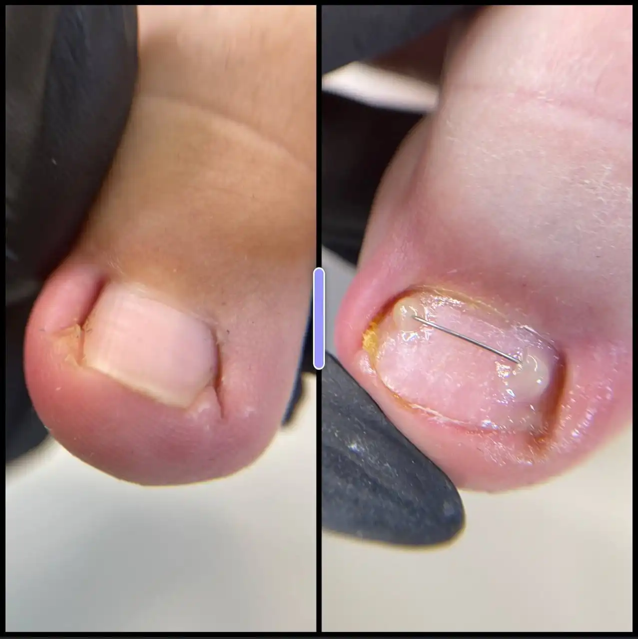 Услуги подолога и обучение маникюру, педикюру в Волгограде - Красота и здоровье (Услуги) в Волгоград