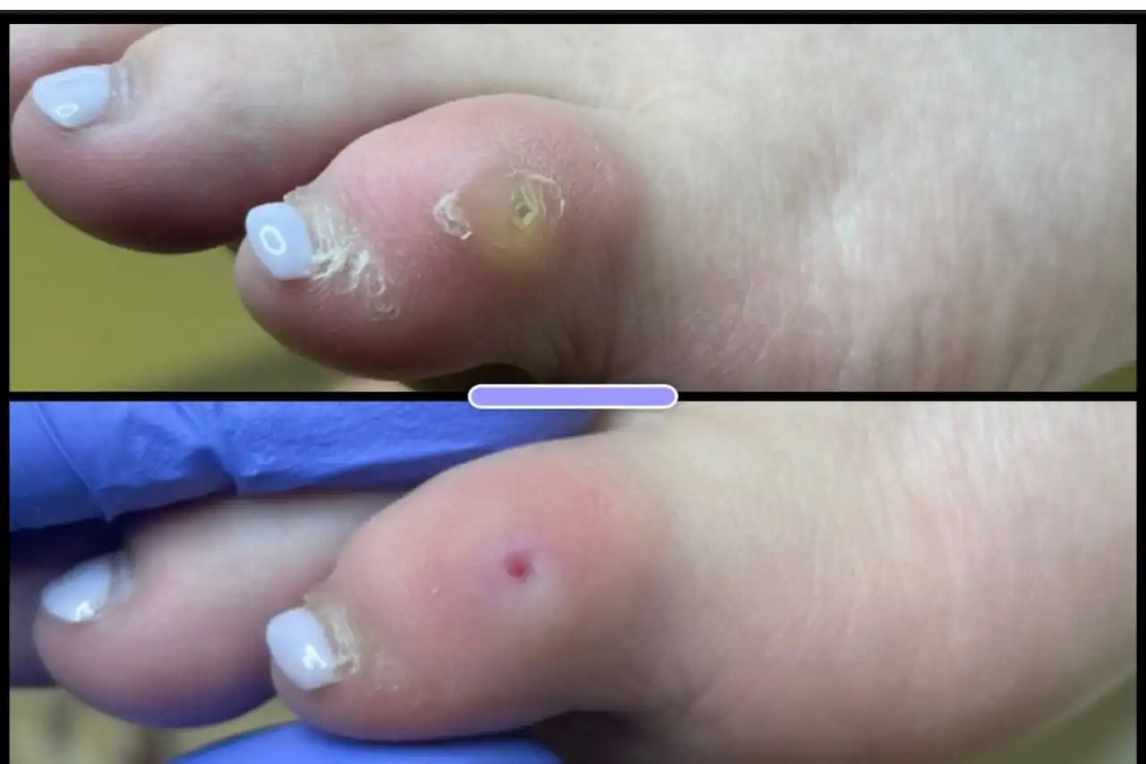 Услуги подолога и обучение маникюру, педикюру в Волгограде - Красота и здоровье (Услуги) в Волгоград