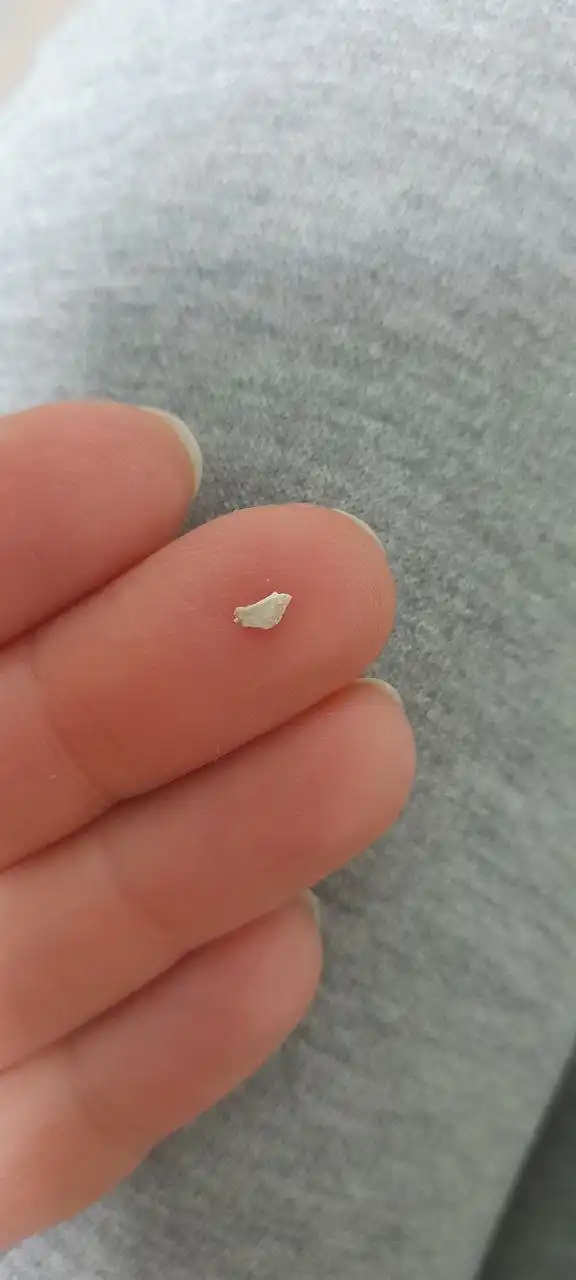 Природные средства для удаления зубного камня - Стоматологические услуги (Услуги) в Волгоград