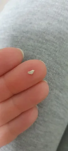 Природные средства для удаления зубного камня - Обучение вождению в Волгоград