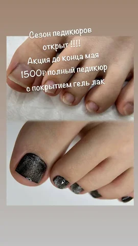 Педикюр с покрытием и без покрытия в Хабаровске - Биологически активные добавки в Хабаровск