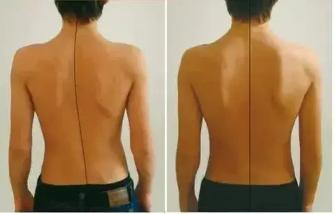 Профессиональный массаж от зажимов и болей в спине - Фотоуслуги в Белгород