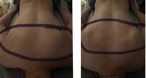 Профессиональный массаж для здоровья и реабилитации - Транспортные услуги в Белгород