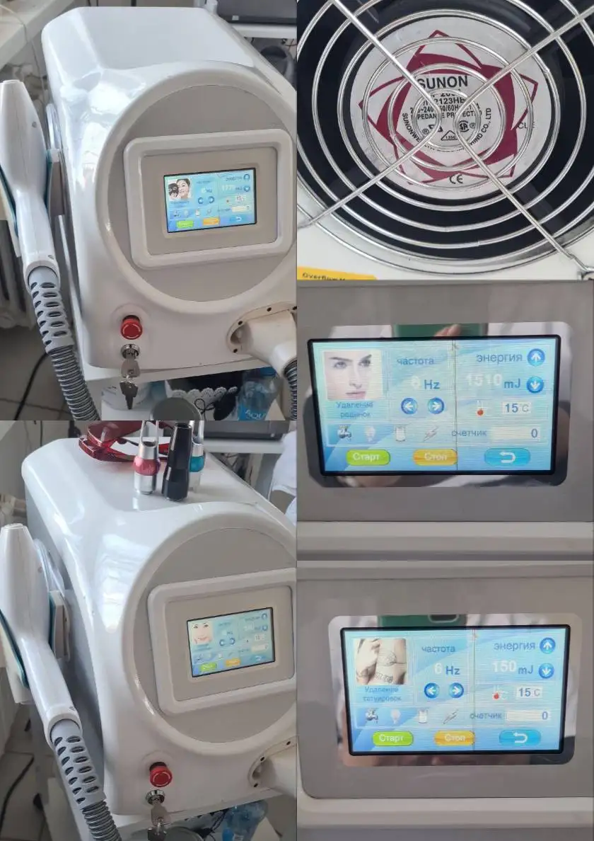 Продам неодимовый лазер Q-switch Nd:YAG для косметологии - Барахолка в Калининград