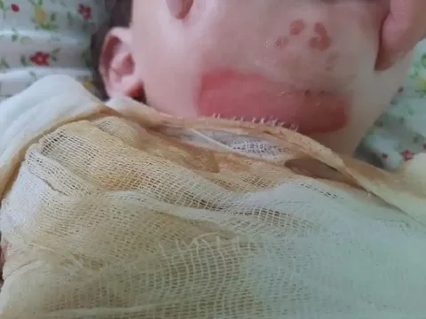 Сбор средств на лечение дочери после обстрела - Аниматоры и ведущие в Воронеж