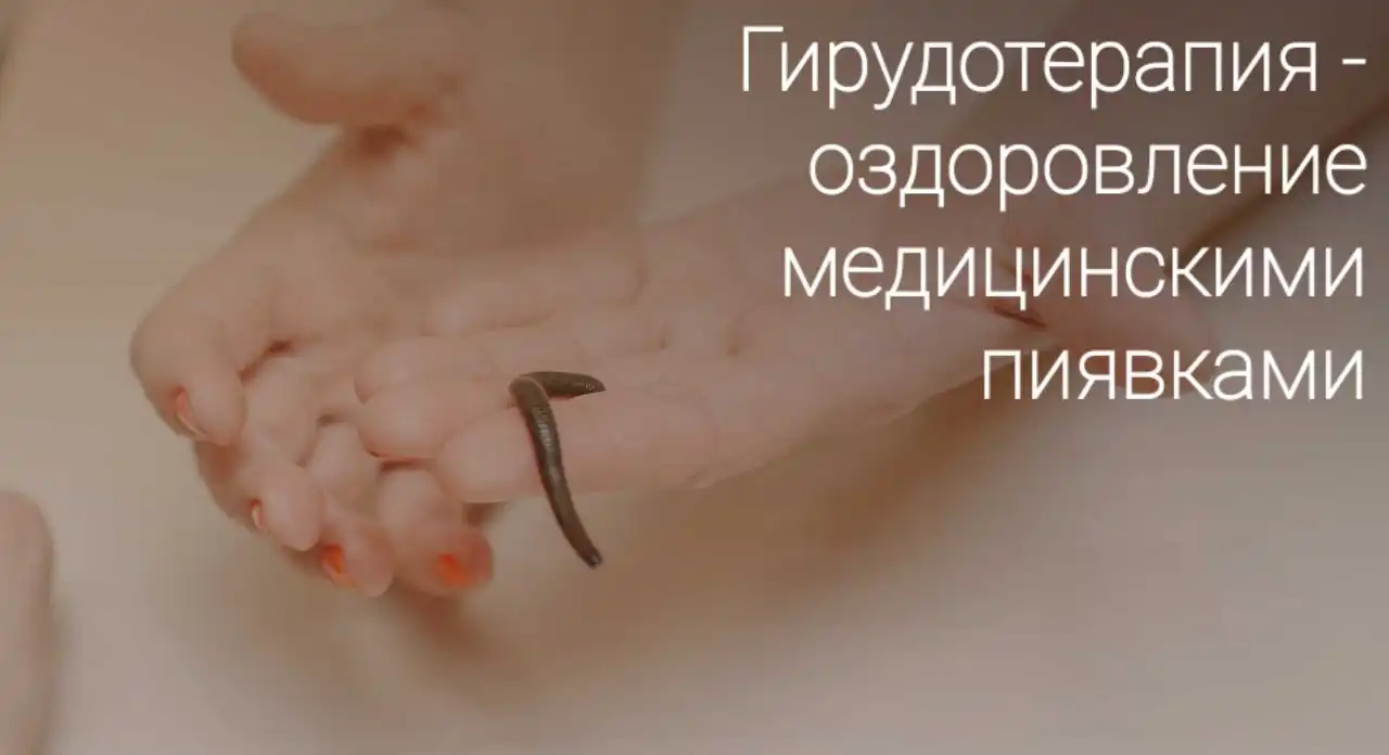 Гирудотерапия в Сочи