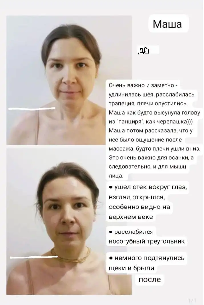 Массаж лица в Сочи от дипломированного специалиста