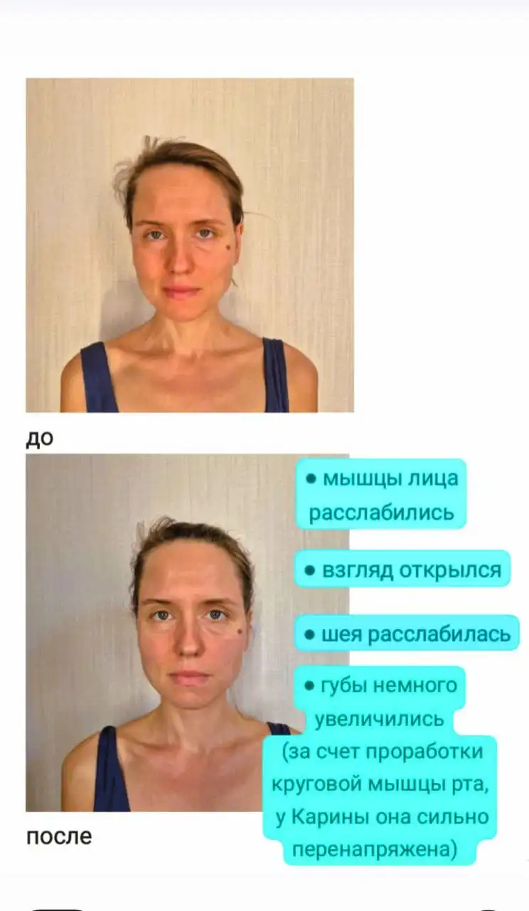 Массаж лица в Сочи от дипломированного специалиста