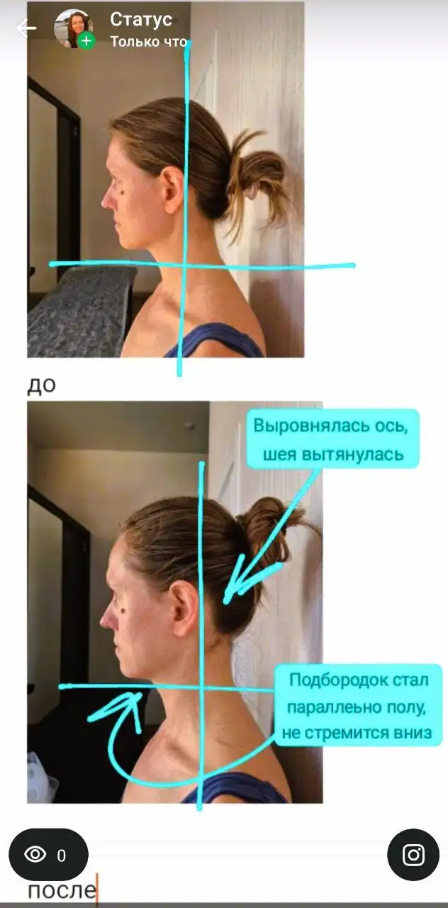 Массаж лица в Сочи от дипломированного специалиста