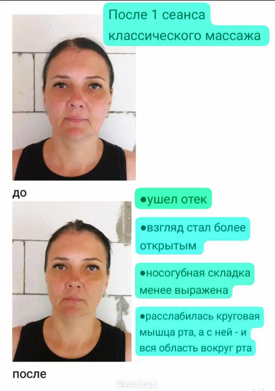 Массаж лица в Сочи от дипломированного специалиста