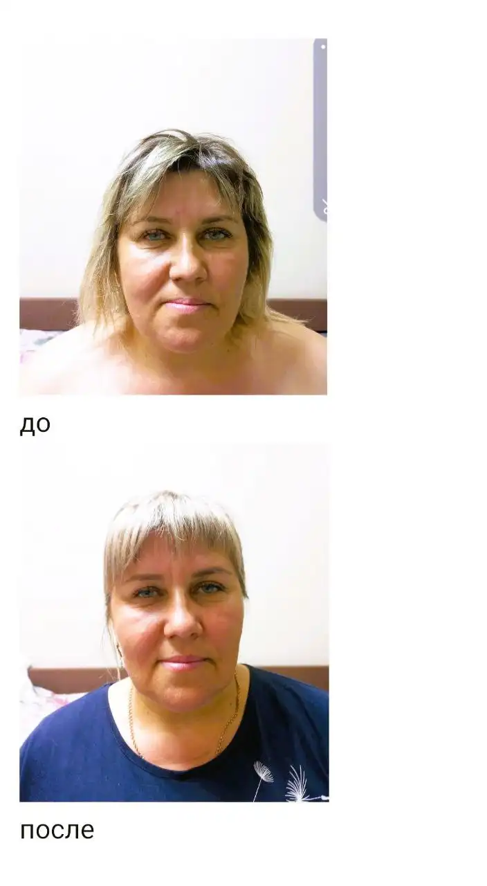 Массаж лица в Сочи от дипломированного специалиста