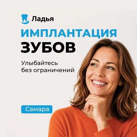 Имплантация зубов в Самаре - Кейтеринг в Самара