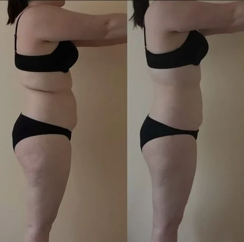 Вакуумно-роликовый массаж для подготовки к лету - Фотосъёмка в Барнаул