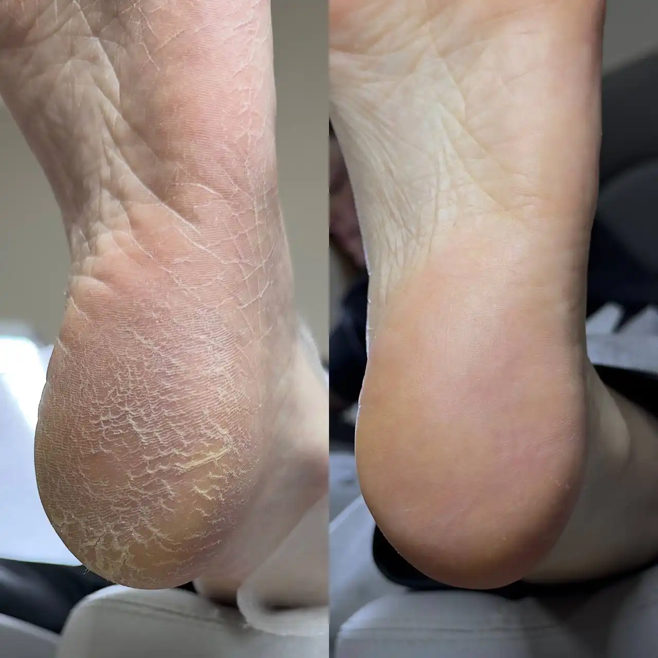 Профессиональный уход за стопами и ногтями в Оренбурге - Красота и здоровье (Услуги) в Оренбург