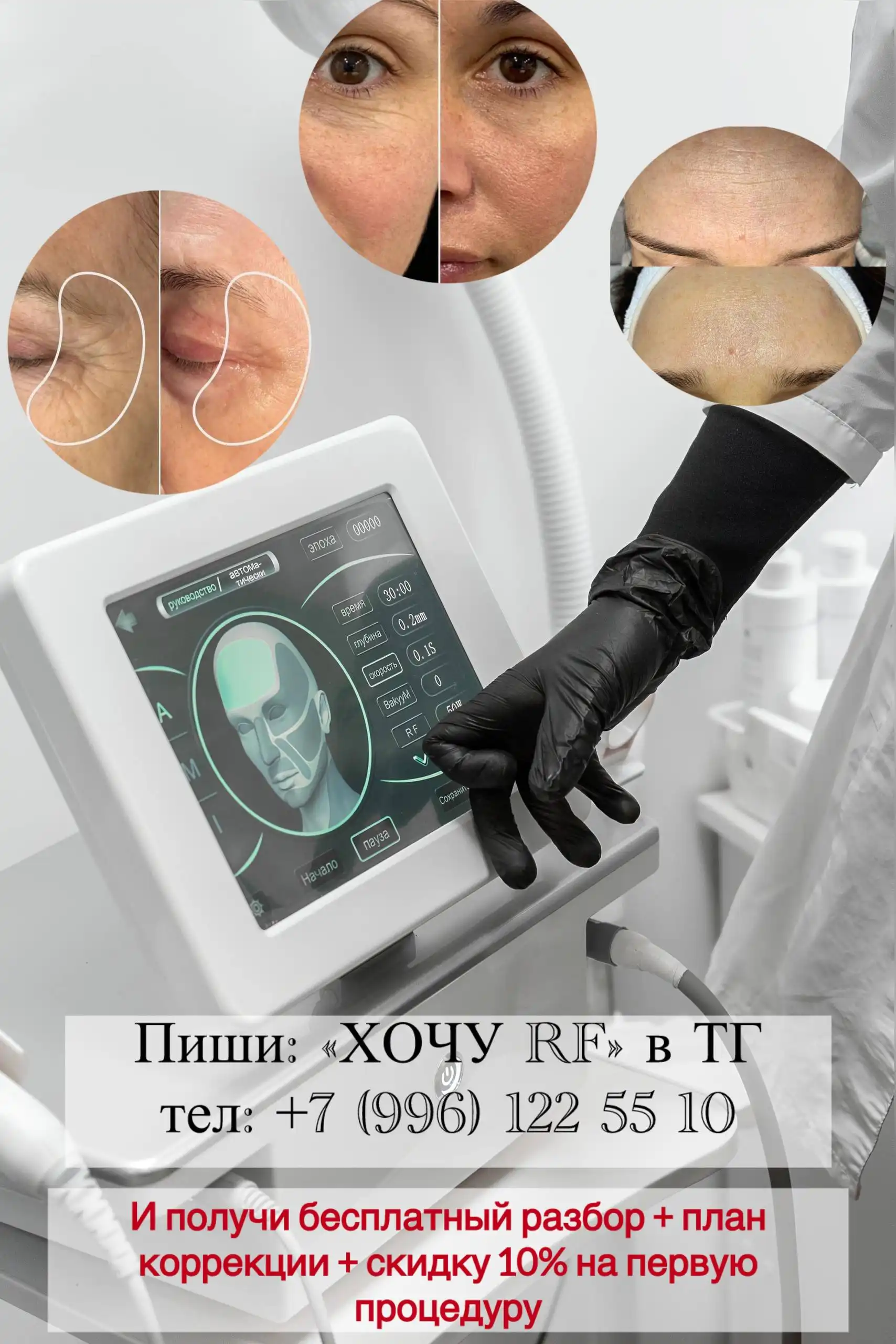 Микроигольчатый RF-лифтинг для подтяжки кожи - Косметология (Услуги) в Набережные Челны