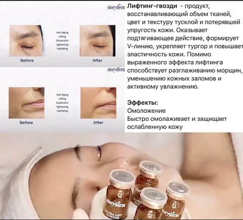 Процедуры красоты от косметолога - частное объявление в Иркутск