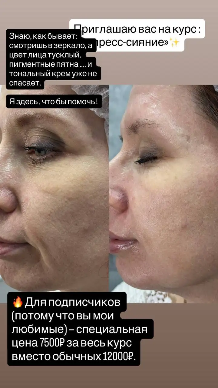 Экспресс-курс «Сияние» для улучшения кожи лица - Косметология (Красота и здоровье) в Краснодар