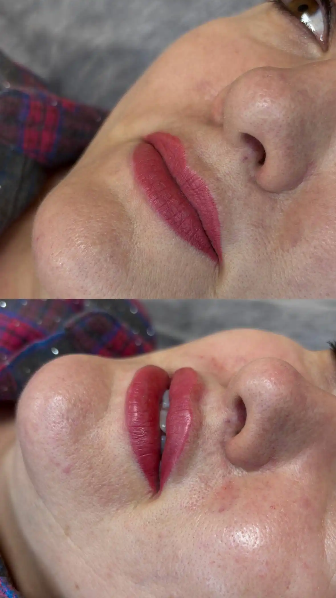 Набор моделей на увеличение губ