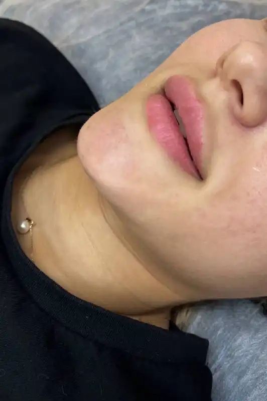 Набор моделей на увеличение губ