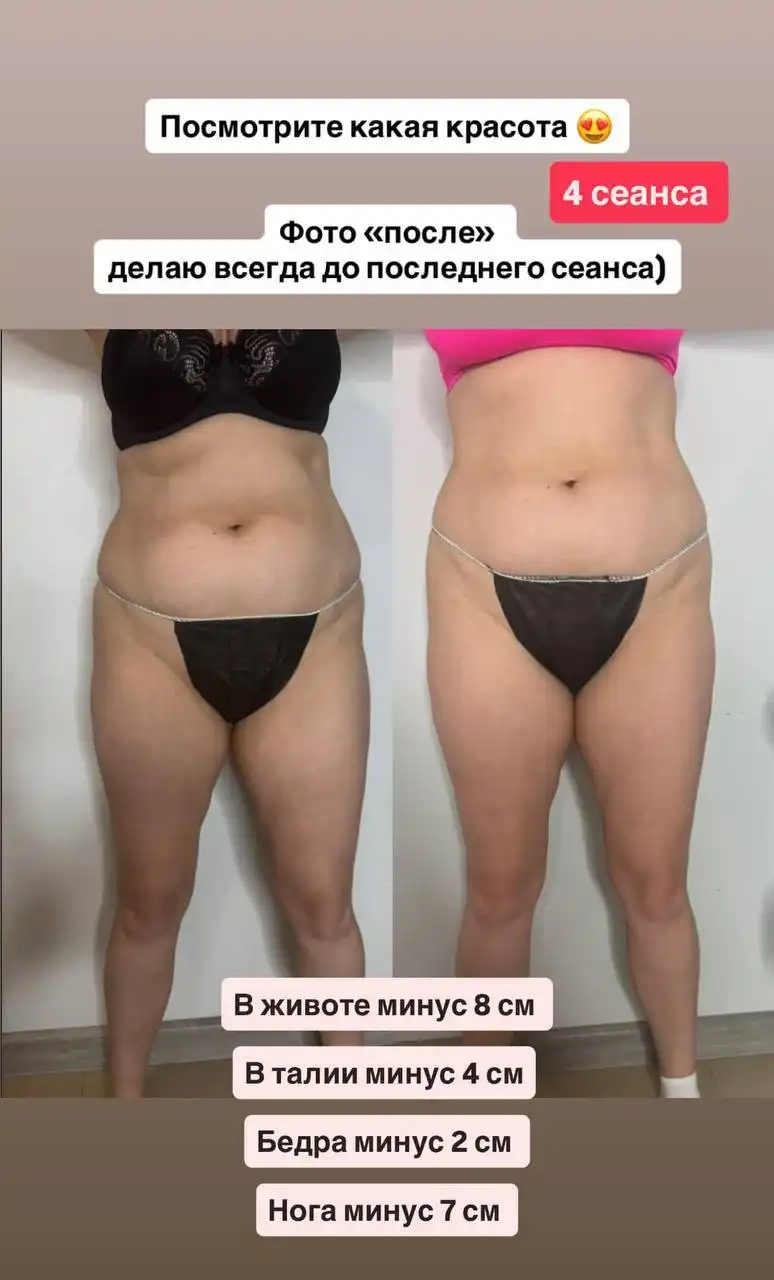 Профессиональный массаж: аппаратный, ручной и инструментальный - Массаж (Услуги) в Пенза