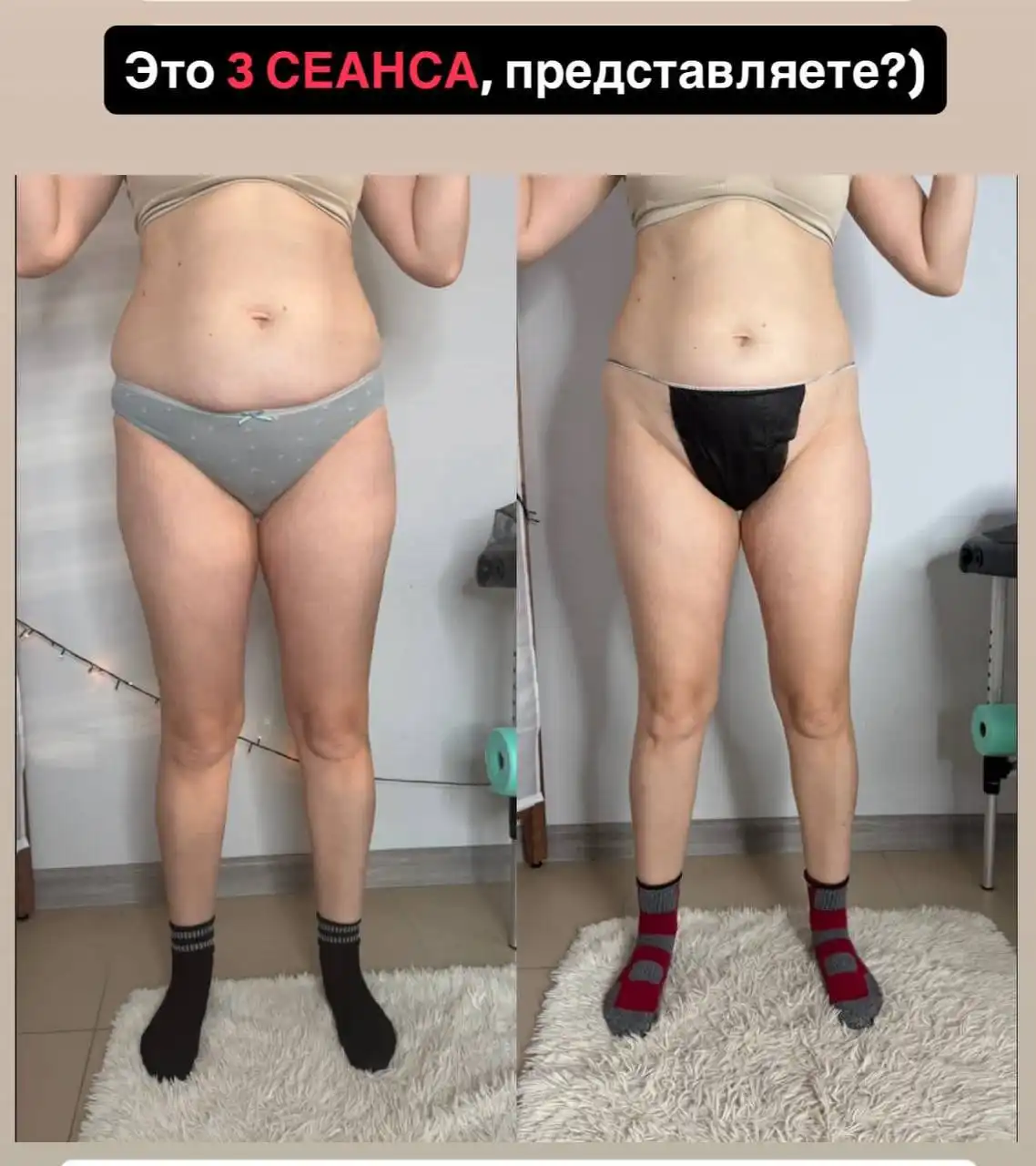 Профессиональный массаж: аппаратный, ручной и инструментальный - Массаж (Услуги) в Пенза