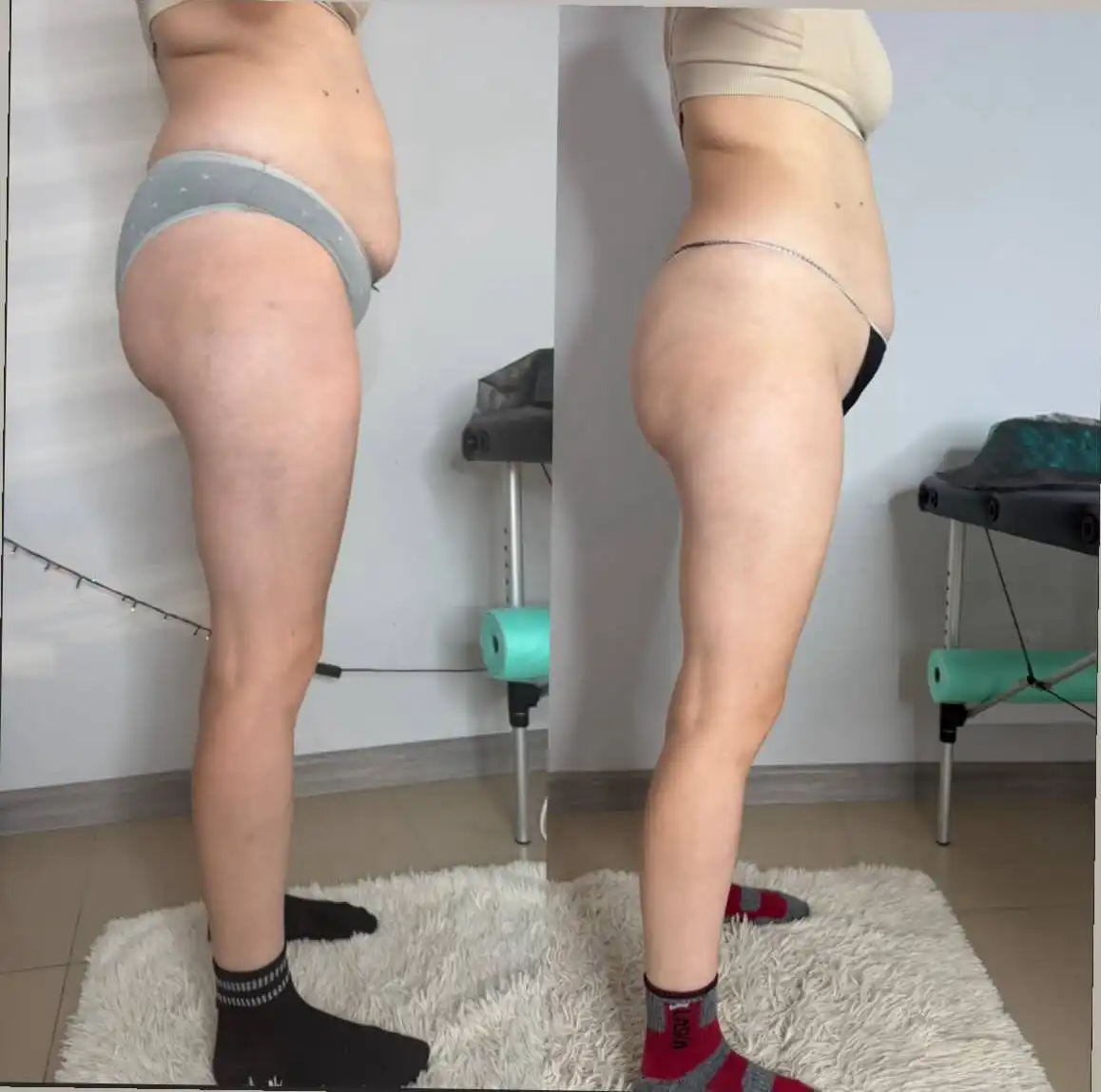 Профессиональный массаж: аппаратный, ручной и инструментальный - Массаж (Услуги) в Пенза