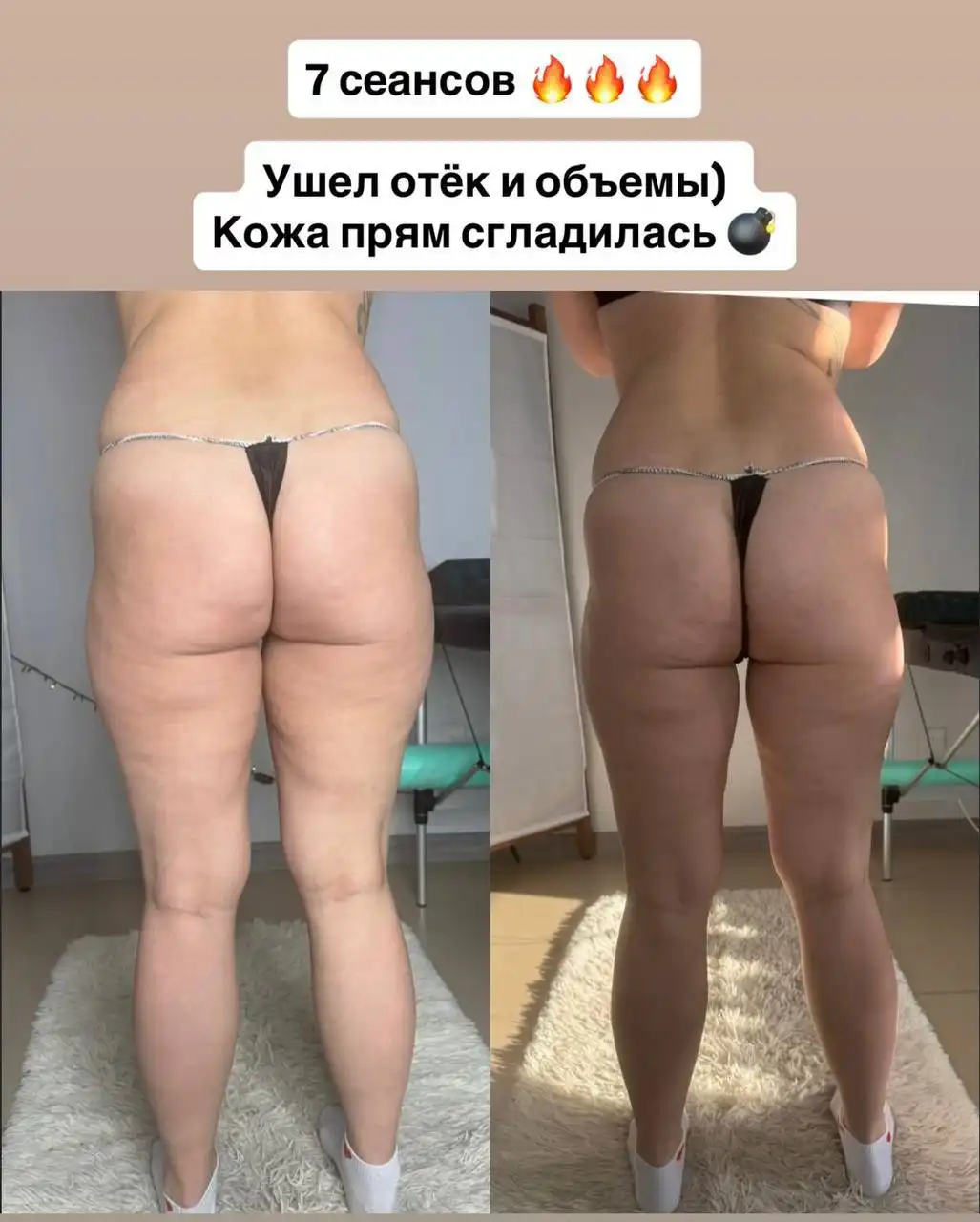 Профессиональный массаж: аппаратный, ручной и инструментальный - Массаж (Услуги) в Пенза