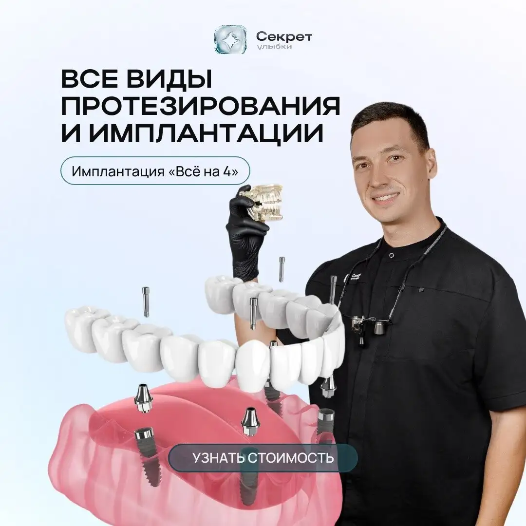 Имплантация в стоматологии 'Секрет Улыбки' - Красота и здоровье в Чебоксары