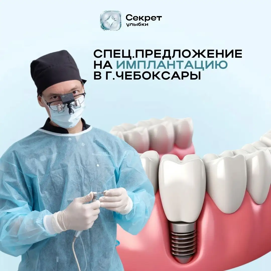 Имплантация зубов в Чебоксарах - Стоматология (Красота и здоровье) в Чебоксары