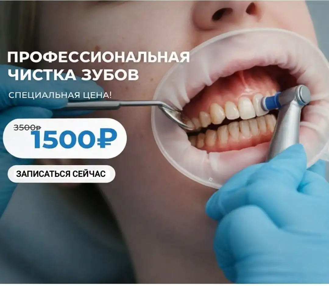 Профессиональная гигиеническая чистка зубов в Симферополе - Стоматологические услуги (Услуги) в Симферополь