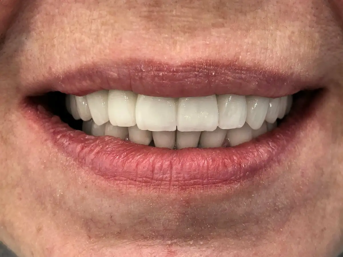 Дента Стар: имплантация с гарантией и комфортом - Медицинские услуги (Услуги) в Шелехов