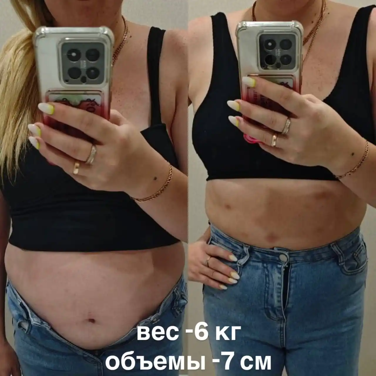 Эстетические процедуры для лица и тела