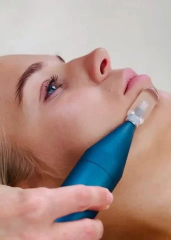 Физиологичное восстановление и естественный лифтинг лица - Красота и здоровье в Чебоксары