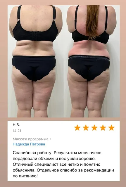 Услуги по коррекции фигуры и лазерной эпиляции - Услуги в Чебоксары