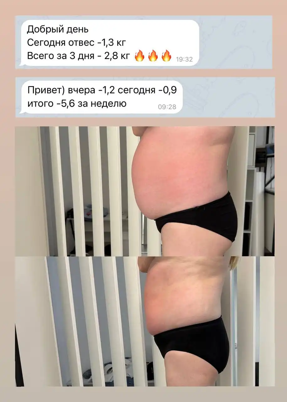 Услуги по коррекции фигуры и лазерной эпиляции