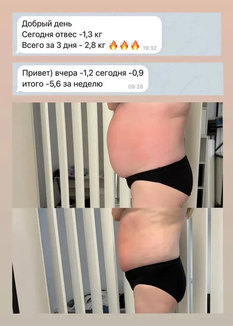 Услуги коррекции фигуры и лазерной эпиляции - частное объявление в Чебоксары