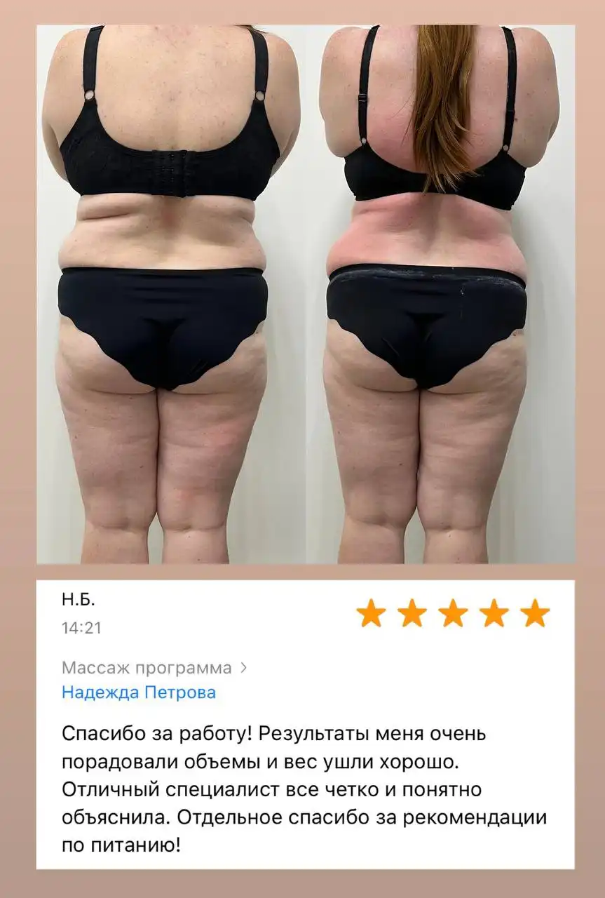 Услуги коррекции фигуры и лазерной эпиляции - Красота и здоровье (Услуги) в Чебоксары