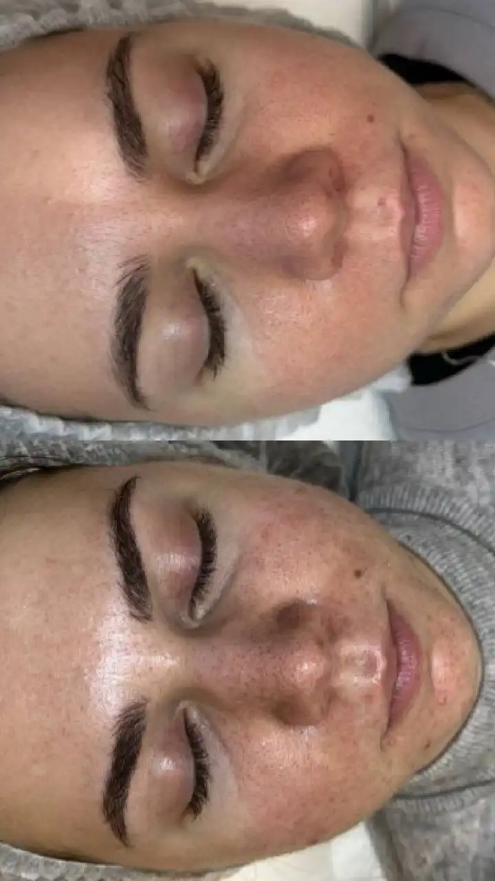 Комплексная чистка кожи 9 шагов от GIGI - Косметология (Услуги) в Чебоксары