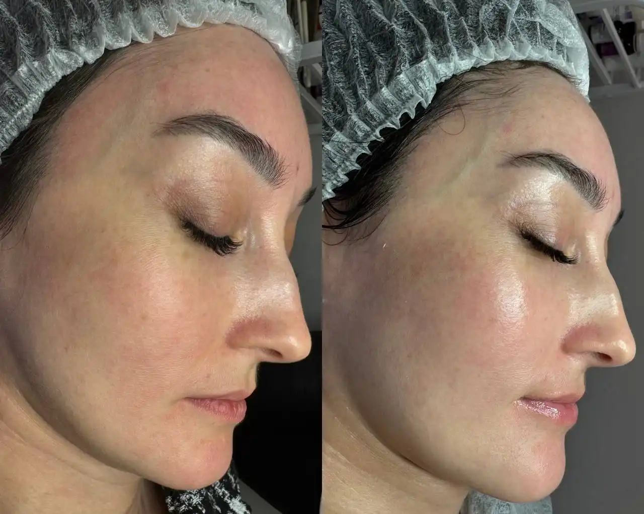 Комплексная чистка кожи 9 шагов от GIGI - Косметология (Услуги) в Чебоксары