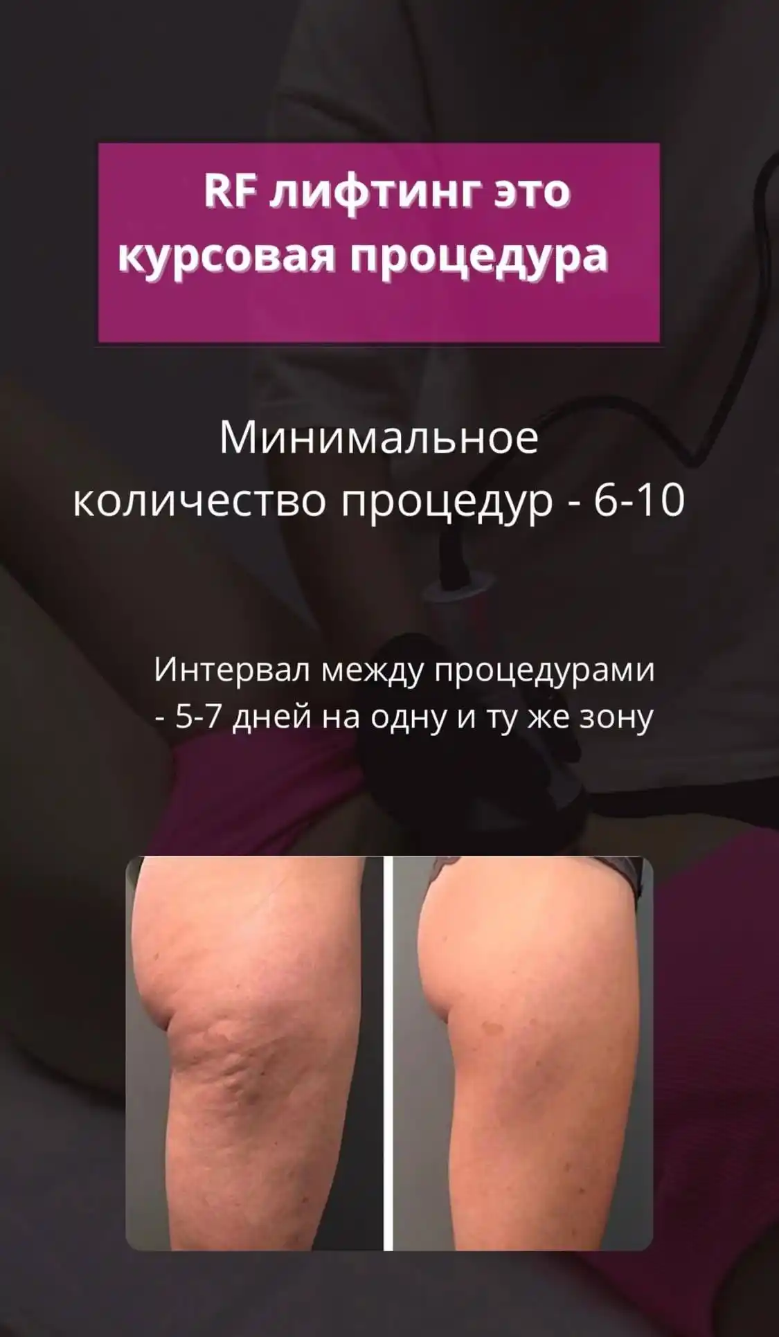 Аппаратный массаж и косметологические процедуры