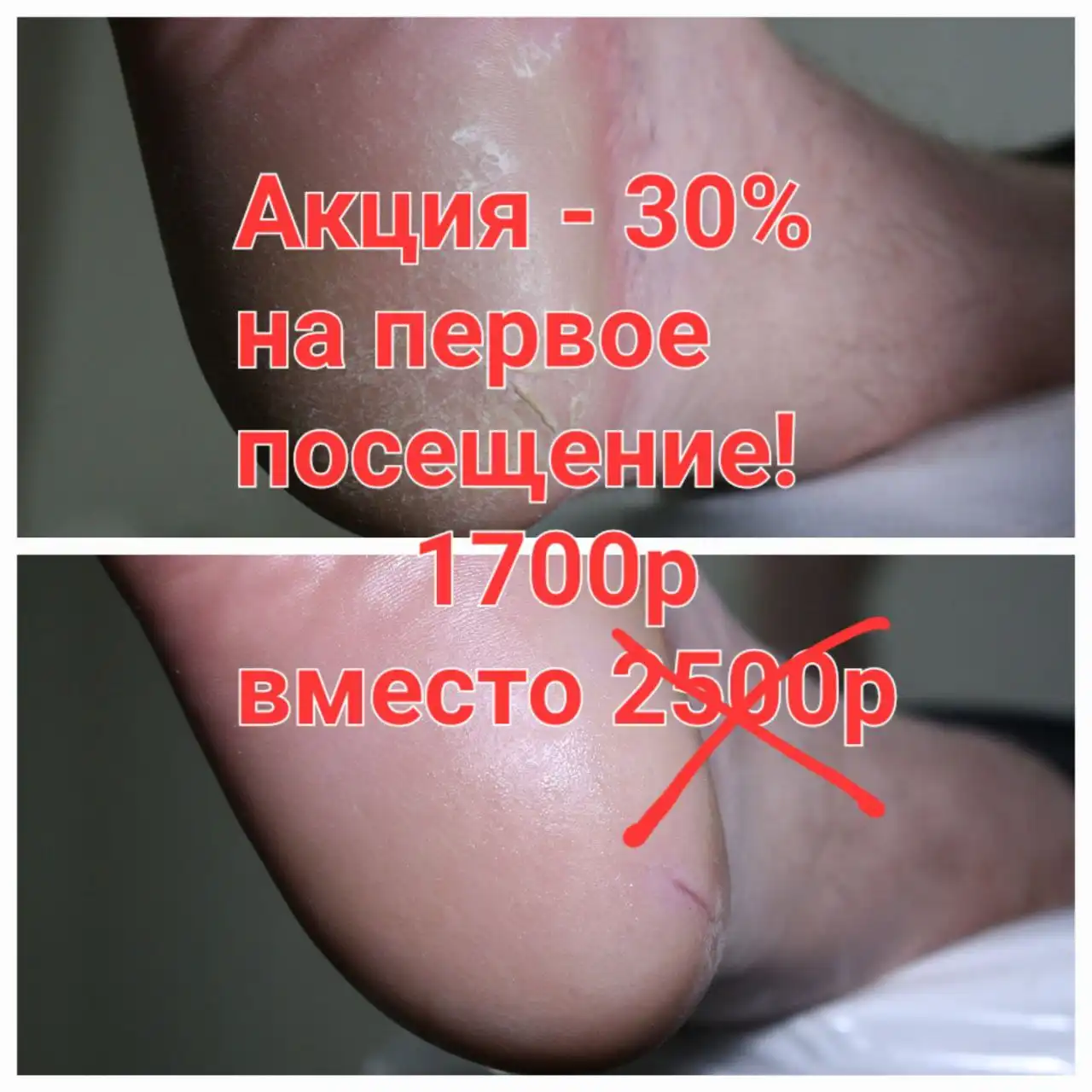 Смарт-педикюр без боли и повреждений - Красота и здоровье (Услуги) в Барнаул