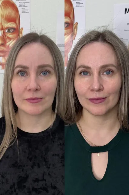 Услуги косметолога Елены Чиркай - Услуги в Ангарск