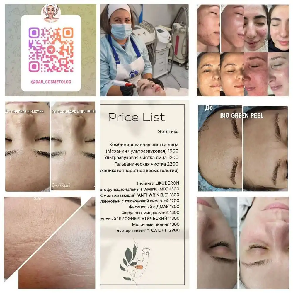 Требуются модели на пилинг и чистку лица - Косметология (Услуги) в Ангарск